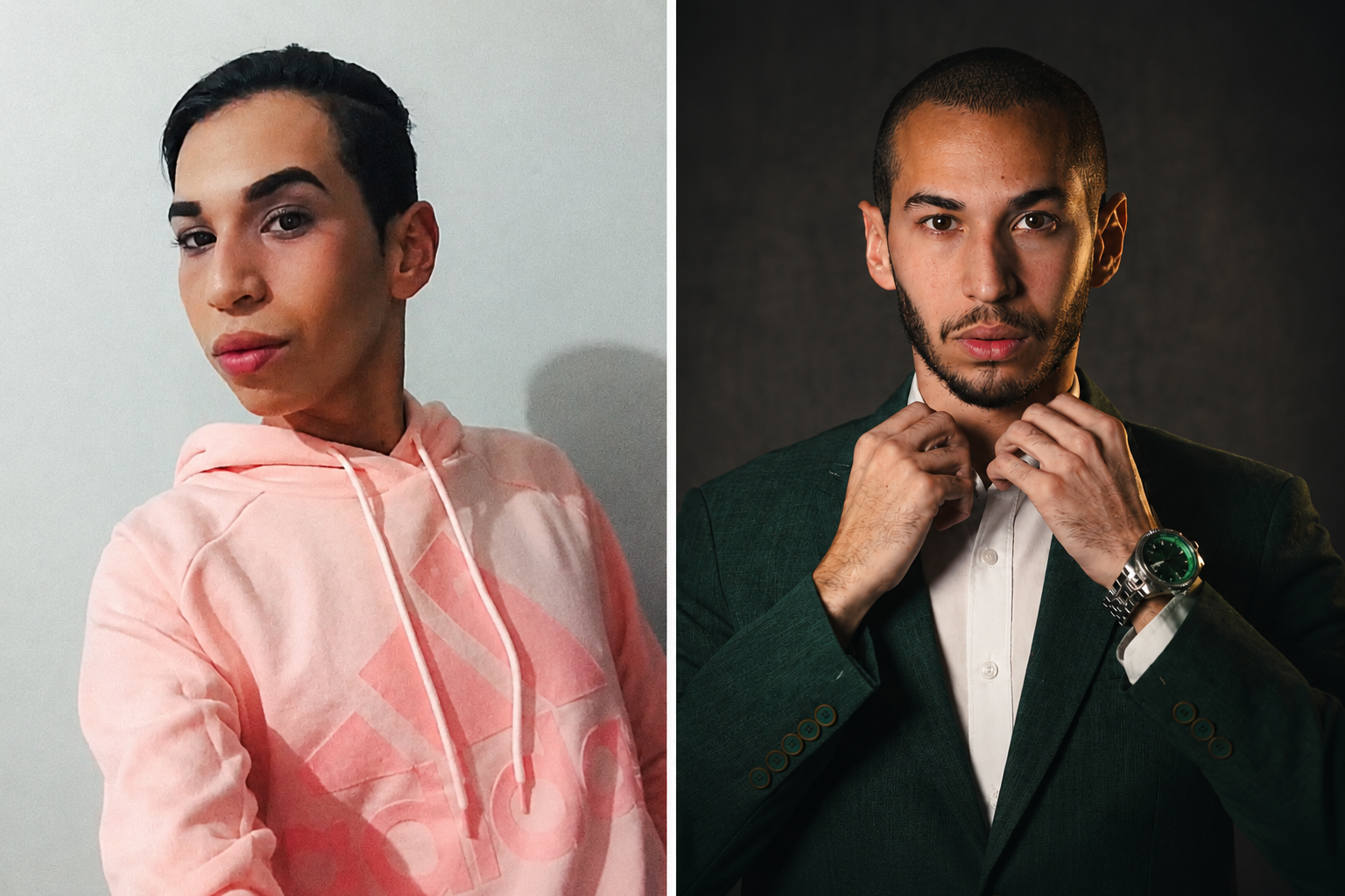 Antes e Depois — Pierry Rodrigues